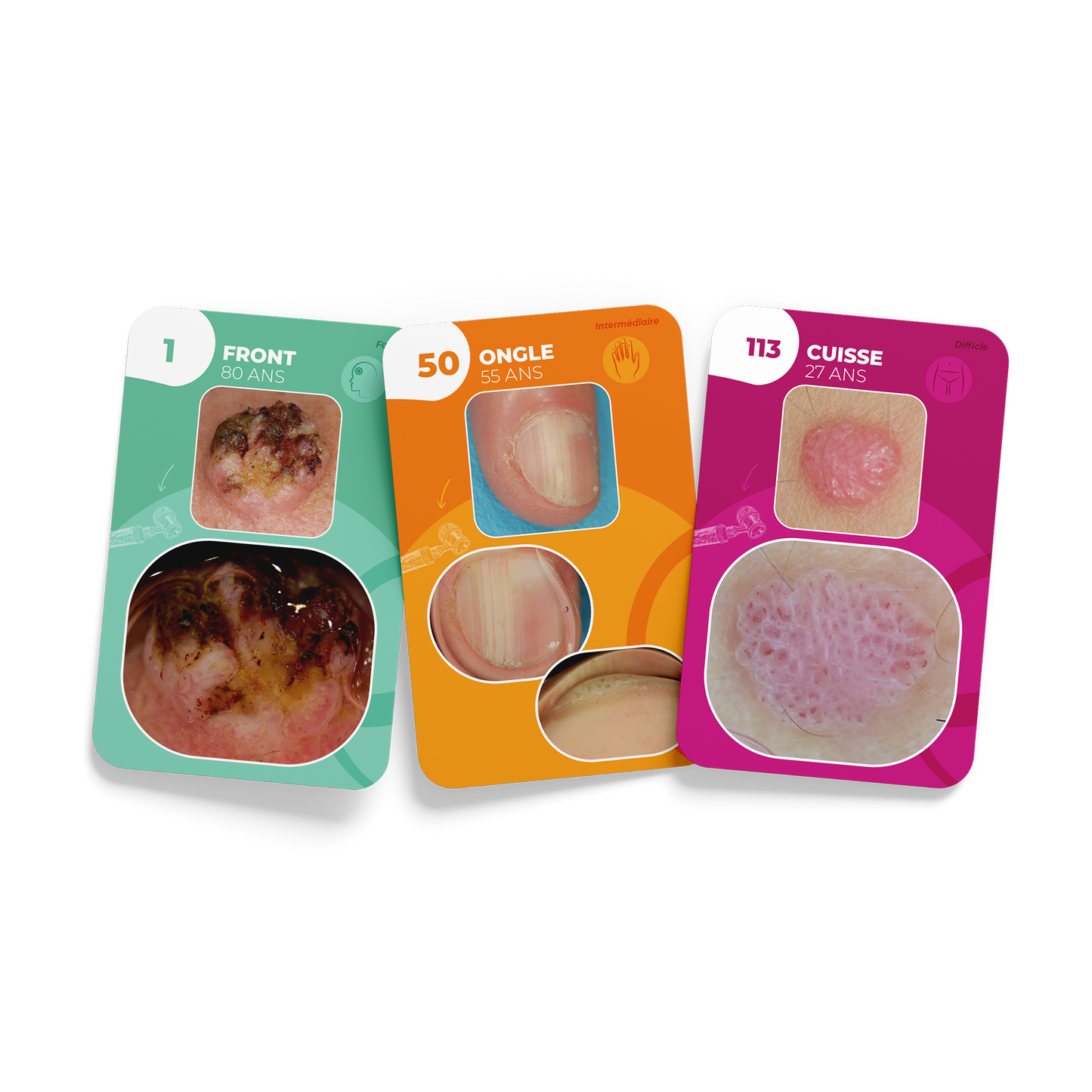Flashcards de la Dermoscopie